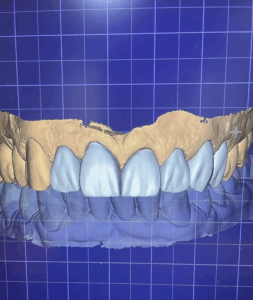 Conheça nosso Laboratório de Prótese Digital!Ateliê DentalCRORS-LB-527EXCLUSIVO para Cirurgiões .00_00_08_02.Quadro002
