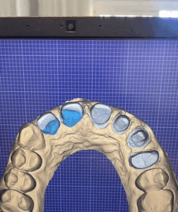 Conheça nosso Laboratório de Prótese Digital!Ateliê DentalCRORS-LB-527EXCLUSIVO para Cirurgiões .00_00_24_00.Quadro003