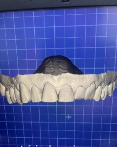Conheça nosso Laboratório de Prótese Digital!Ateliê DentalCRORS-LB-527EXCLUSIVO para Cirurgiões-0015